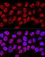 hnRNP A2B1 Antibody in Immunocytochemistry (ICC/IF)