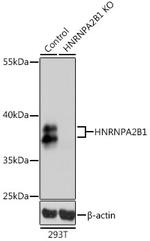 hnRNP A2B1 Antibody in Western Blot (WB)