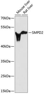 SMPD2 Antibody in Western Blot (WB)