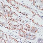 ACSL3 Antibody in Immunohistochemistry (Paraffin) (IHC (P))