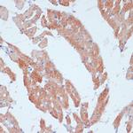 ACSL3 Antibody in Immunohistochemistry (Paraffin) (IHC (P))