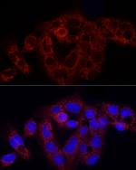 RPS18 Antibody in Immunocytochemistry (ICC/IF)