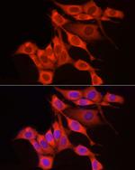 RPS18 Antibody in Immunocytochemistry (ICC/IF)