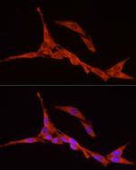 RPS18 Antibody in Immunocytochemistry (ICC/IF)