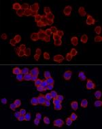 RPS18 Antibody in Immunocytochemistry (ICC/IF)