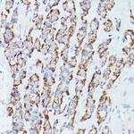 RPS18 Antibody in Immunohistochemistry (Paraffin) (IHC (P))