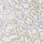 RPS18 Antibody in Immunohistochemistry (Paraffin) (IHC (P))