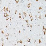 RPS18 Antibody in Immunohistochemistry (Paraffin) (IHC (P))