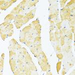 DDX3Y Antibody in Immunohistochemistry (Paraffin) (IHC (P))