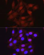 beta-Arrestin 2 Antibody in Immunocytochemistry (ICC/IF)