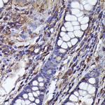 beta-Arrestin 2 Antibody in Immunohistochemistry (Paraffin) (IHC (P))