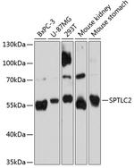 SPTLC2 Antibody in Western Blot (WB)