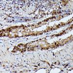 GADD45A Antibody in Immunohistochemistry (Paraffin) (IHC (P))