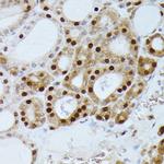 GADD45A Antibody in Immunohistochemistry (Paraffin) (IHC (P))