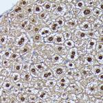 GADD45A Antibody in Immunohistochemistry (Paraffin) (IHC (P))