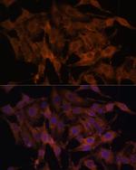 TLR3 Antibody in Immunocytochemistry (ICC/IF)