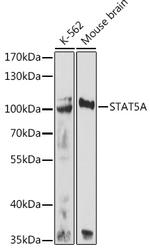 STAT5 alpha Antibody in Western Blot (WB)