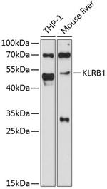 KLRB1 Antibody in Western Blot (WB)