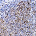 TGFBR2 Antibody in Immunohistochemistry (Paraffin) (IHC (P))