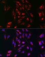 RAB5 Antibody in Immunocytochemistry (ICC/IF)