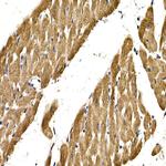 PDGF-BB Antibody in Immunohistochemistry (Paraffin) (IHC (P))