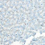 LNPEP Antibody in Immunohistochemistry (Paraffin) (IHC (P))