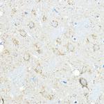 LNPEP Antibody in Immunohistochemistry (Paraffin) (IHC (P))