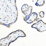 LNPEP Antibody in Immunohistochemistry (Paraffin) (IHC (P))