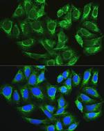 ATG16L1 Antibody in Immunocytochemistry (ICC/IF)