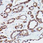 ATG16L1 Antibody in Immunohistochemistry (Paraffin) (IHC (P))