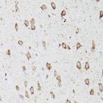 ATG16L1 Antibody in Immunohistochemistry (Paraffin) (IHC (P))