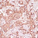 BYSL Antibody in Immunohistochemistry (Paraffin) (IHC (P))