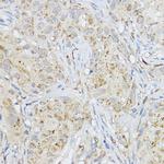 MMP3 Antibody in Immunohistochemistry (Paraffin) (IHC (P))