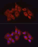 TAK1 Antibody in Immunocytochemistry (ICC/IF)