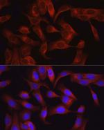 TAK1 Antibody in Immunocytochemistry (ICC/IF)