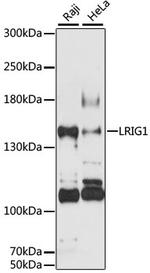 LRIG1 Antibody in Western Blot (WB)