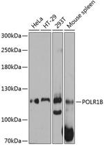 POLR1B Antibody in Western Blot (WB)