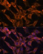 RAB21 Antibody in Immunocytochemistry (ICC/IF)