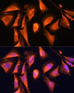 RAB21 Antibody in Immunocytochemistry (ICC/IF)