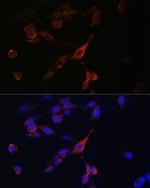 RAB21 Antibody in Immunocytochemistry (ICC/IF)