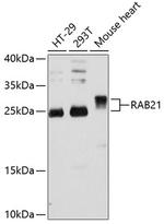 RAB21 Antibody in Western Blot (WB)