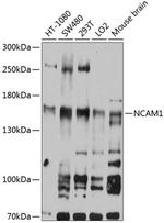 CD56 Antibody in Western Blot (WB)