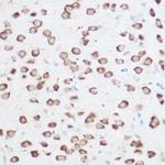 RPS24 Antibody in Immunohistochemistry (Paraffin) (IHC (P))