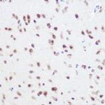 SART3 Antibody in Immunohistochemistry (Paraffin) (IHC (P))