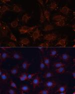 SLC25A24 Antibody in Immunocytochemistry (ICC/IF)