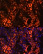 BHMT Antibody in Immunocytochemistry (ICC/IF)