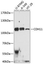 CDH11 Antibody in Western Blot (WB)