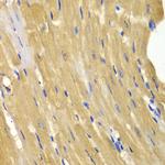 Adenylate Kinase 1 Antibody in Immunohistochemistry (Paraffin) (IHC (P))