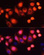 H-Ras Antibody in Immunocytochemistry (ICC/IF)