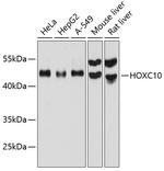 HOXC10 Antibody in Western Blot (WB)